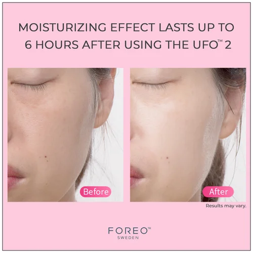 FOREO UFO 2 Device - Black Image 4